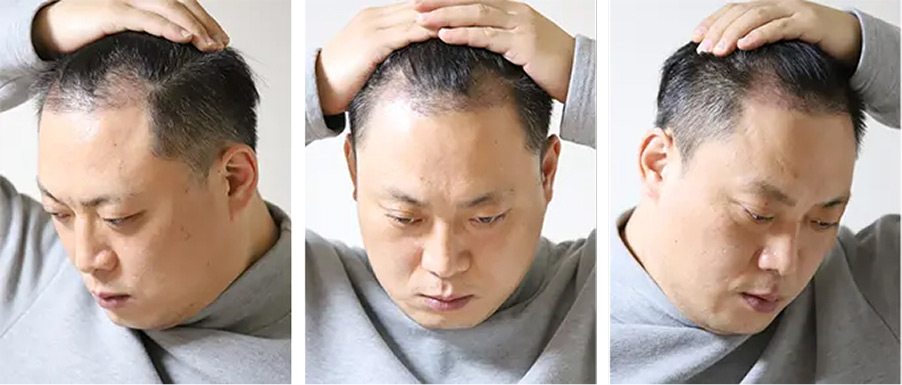 사진 첨부 예시
