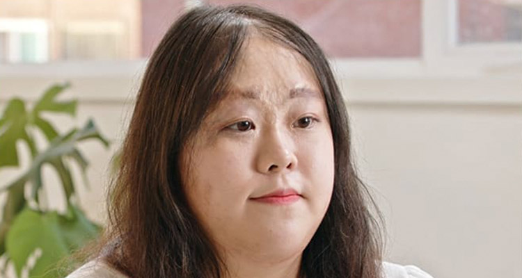 모제림 여성 흉터 모발이식
