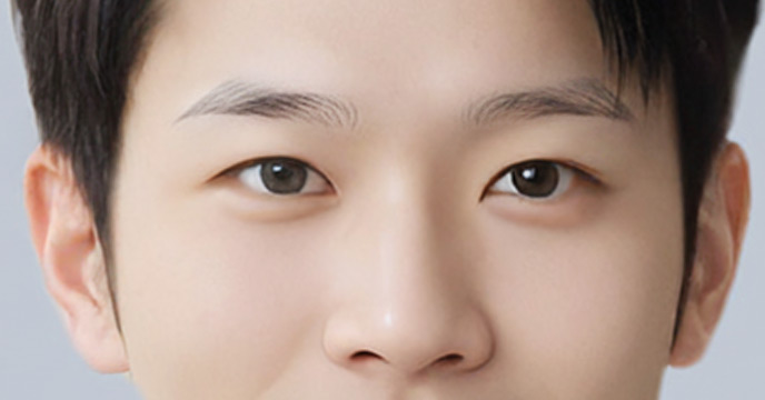 눈썹이식 대상