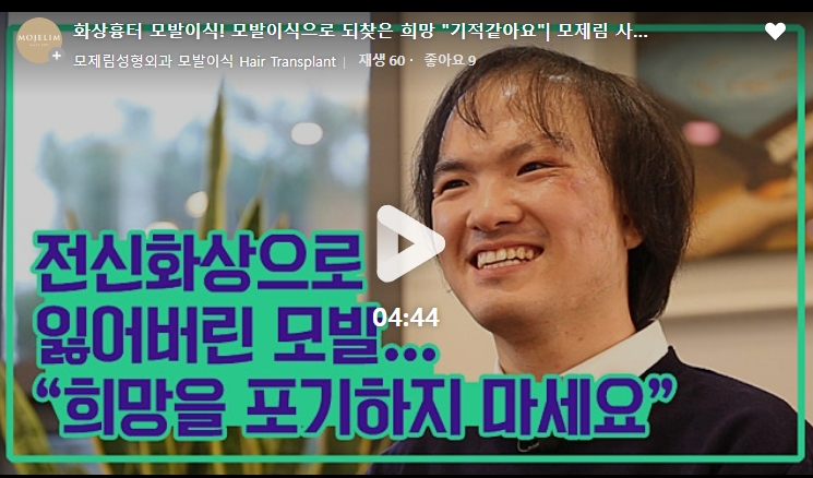 화상흉터 리얼스토리 1