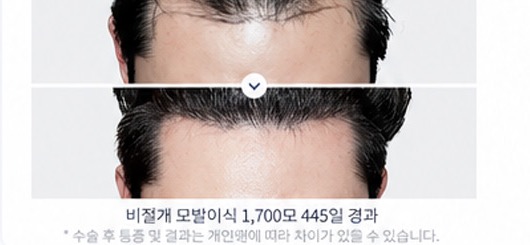 수술후기