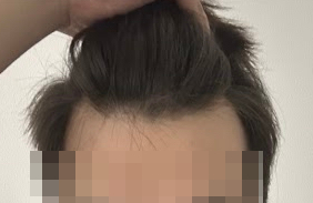 2,300모 상담 및 당일 후기